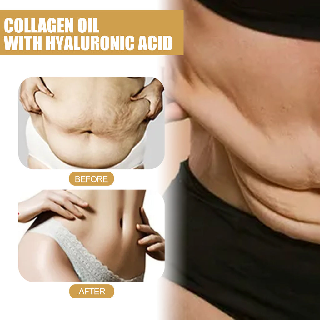 Firming Collagen Oil, Shows The Curves Of The Body, Firming Shaping And Slimming Body Essential Oil